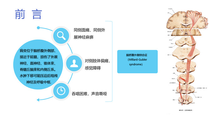 脑出血护理个案分析PPT模板_第1页PPT效果图