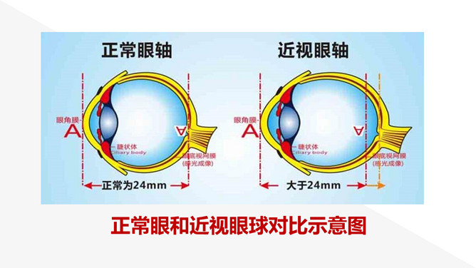 保护视力预防近视班会PPT模板_第5页PPT效果图